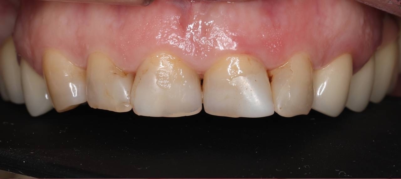 Фото работы Эстетическое преображение улыбки 2