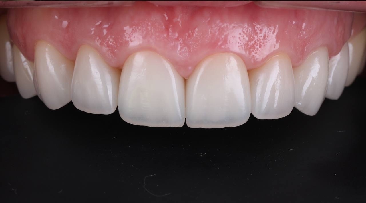 Фото работы Эстетическое преображение улыбки 1
